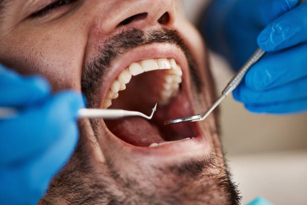 Best Urgent Dental Care for Toothache in East Dubuque, IL